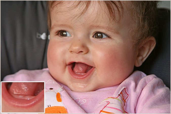 dientes